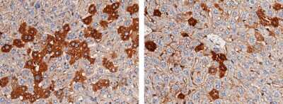 Immunohistochemistry-Paraffin: Fetuin A/AHSG Antibody (022) [NBP2-90416] - Immunochemical staining of mouse Fetuin A/AHSG in mouse liver (from 2 donors) with rabbit monoclonal antibody (1:200, formalin-fixed paraffin embedded sections).