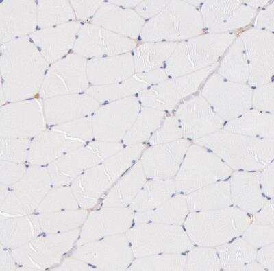 Immunohistochemistry-Paraffin: Fetuin A/AHSG Antibody [NBP1-90302] - Staining of human skeletal muscle shows no cytoplasmic positivity in myocytes as expected