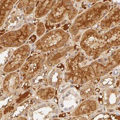 Immunohistochemistry-Paraffin: Fetuin A/AHSG Antibody [NBP1-90303] - Staining of human kidney shows moderate extra-cellular positivity and moderate cytoplasmic positivity in cells in tubules.