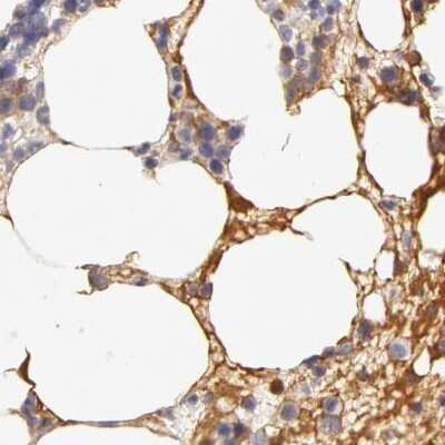 Immunohistochemistry-Paraffin: Fetuin A/AHSG Antibody [NBP1-90303] - Staining of human bone marrow.