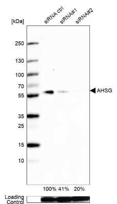 Western Blot: Fetuin A/AHSG Antibody [NBP1-90303] - Analysis in Caco-2 cells transfected with control siRNA, target specific siRNA probe #1 and #2,. Remaining relative intensity is presented. Loading control: Anti-GAPDH.