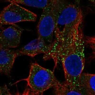 Immunocytochemistry/Immunofluorescence: Fetuin Antibody [NBP3-17712] - Staining of human cell line Hep G2 shows localization to vesicles.