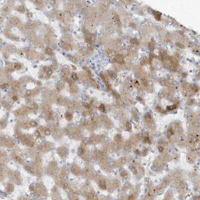 Immunohistochemistry-Paraffin: Fetuin Antibody [NBP1-91192] - Staining of human liver shows moderate cytoplasmic positivity in hepatocytes.