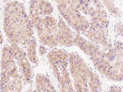 Immunohistochemistry-Paraffin: Fetuin Antibody [NBP2-99415] - Immunochemical staining of human Fetuin in human liver with rabbit polyclonal antibody at 1:300 dilution, formalin-fixed paraffin embedded sections.