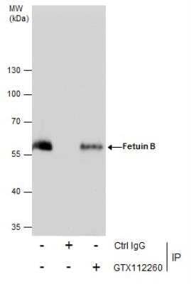 Immunoprecipitation: Fetuin Antibody [NBP2-16470] - Immunoprecipitation of Fetuin protein from SK-N-SH whole cell extracts using 5 ug of Fetuin antibody. Western blot analysis was performed using Fetuin antibody.