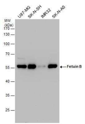 Western Blot Fetuin Antibody