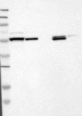 Western Blot: Fgr Antibody [26700002] - Samples:  Lane 1, Marker [kDa]: 250, 130, 95, 72, 55, 36, 28, 17, 11  Lane 2, RT-4  Lane 3, U-251MG sp Lane 4, Human Plasma  Lane 5, Liver  Lane 6, Tonsil , Target weight [kDa]: 59 Validation score: 2  Validation description: Supportive - Band of predicted size in kDa (+/-20%) with additional bands present.