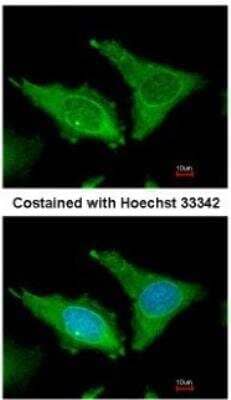 Immunocytochemistry/Immunofluorescence: Fibrinogen beta chain Antibody [NBP1-33582] - Analysis of methanol-fixed HeLa, using antibody at 1:200 dilution.