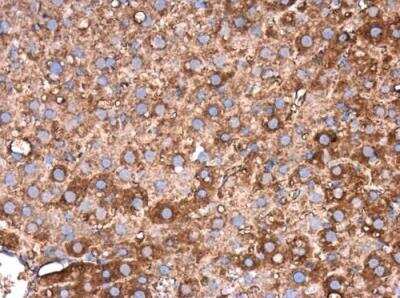 Immunohistochemistry-Paraffin Fibrinogen beta chain Antibody - BSA Free