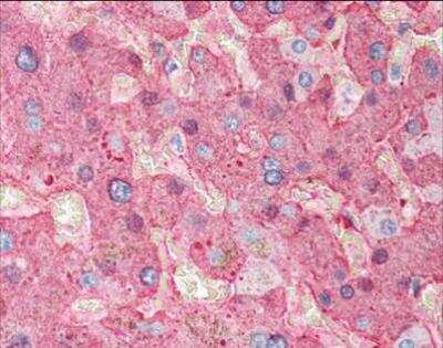 Immunohistochemistry-Paraffin: Fibrinogen Antibody [NBP2-50087] - Tissue: human liver tissue. Fixation: formalin fixed paraffin embedded. Antigen retrieval: not required. Primary antibody: Fibrinogen antibody at 1:500 for 1 h at RT. Secondary antibody: Peroxidase goat secondary antibody at 1:10,000 for 45 min at RT. Localization: Fibrinogen is localized in plasma. Staining: Fibrinogen as precipitated red signal with hematoxylin purple nuclear counterstain.