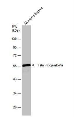 Western Blot: Fibrinogen beta chain Antibody [NBP1-33582] - Mouse tissue extract (30 ug) was separated by 10% SDS-PAGE, and the membrane was blotted with Fibrinogen beta chain antibody diluted at 1:50000.