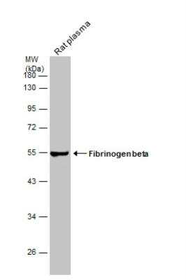 Western Blot: Fibrinogen beta chain Antibody [NBP1-33582] - Rat tissue extract (30 ug) was separated by 10% SDS-PAGE, and the membrane was blotted with Fibrinogen beta chain antibody diluted at 1:50000.