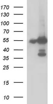 Western Blot: Fibrinogen gamma chain Antibody (2D2) [NBP2-45663] - Analysis of HEK293T cells were transfected with the pCMV6-ENTRY control (Left lane) or pCMV6-ENTRY Fibrinogen gamma chain.