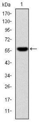 Western Blot: Fibrinogen gamma chain Antibody (4H9) [NBP2-37556] - Western blot analysis using FGG mAb against human FGG (AA: 210-437) recombinant protein. (Expected MW is 51.5 kDa)