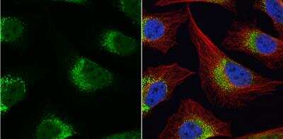 Immunocytochemistry/Immunofluorescence: Fibrinogen gamma chain Antibody [NBP1-32436] - HeLa cells were fixed in 4% paraformaldehyde at RT for 15 min. Green: Fibrinogen gamma protein stained by Fibrinogen gamma antibody  diluted at 1:500. Red: alpha Tubulin, a cytoskeleton marker, stained by alpha Tubulin antibody [B-5-1-2]  diluted at 1:10000. Blue:  Hoechst 33342 staining.