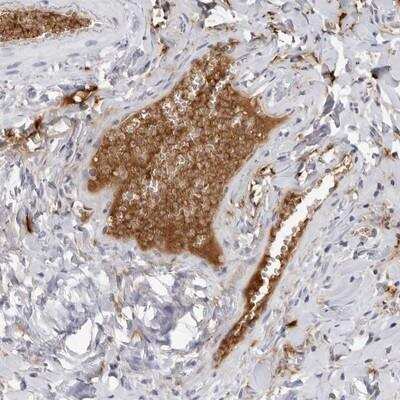 Immunohistochemistry: Fibrinogen gamma chain Antibody [NBP1-87448] - Staining of human gall bladder shows distinct positivity in plasma.