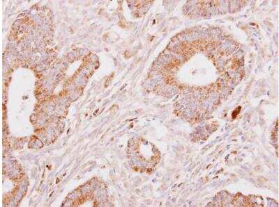 Immunohistochemistry-Paraffin: Fibrinogen gamma chain Antibody [NBP1-31766] - Sample: Fibrinogen gamma chain antibody dilution: 1:250.