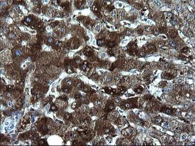 Immunohistochemistry: Fibrinogen gamma chain Antibody (OTI2D2) - Azide and BSA Free [NBP2-70732] - Analysis of Human liver tissue. (Heat-induced epitope retrieval by 1 mM EDTA in 10mM Tris, pH8.5, 120C for 3min)