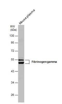 Western Blot: Fibrinogen gamma chain Antibody [NBP1-31766] - Mouse tissue extracts (50 ug) was separated by 10% SDS-PAGE, and the membrane was blotted with Fibrinogen gamma antibody diluted at 1:1000.