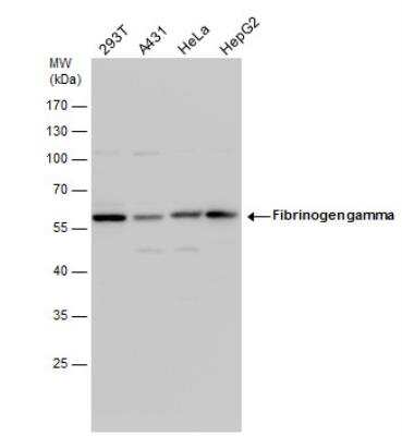 Western Blot: Fibrinogen gamma chain Antibody [NBP1-31766] - Various whole cell extracts (30 ug) were separated by 10% SDS-PAGE, and the membrane was blotted with Fibrinogen gamma chain antibody diluted by 1:1000.