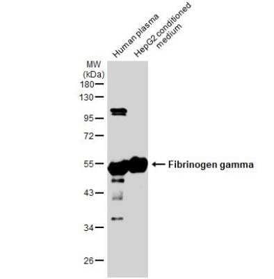 Western Blot: Fibrinogen gamma chain Antibody [NBP1-32436] - Human plasma and HepG2 conditioned medium (30 ug) were separated by 10% SDS-PAGE, and the membrane was blotted with Fibrinogen gamma antibody diluted at 1:10000. The HRP-conjugated anti-rabbit IgG antibody (NBP2-19301) was used to detect the primary antibody.