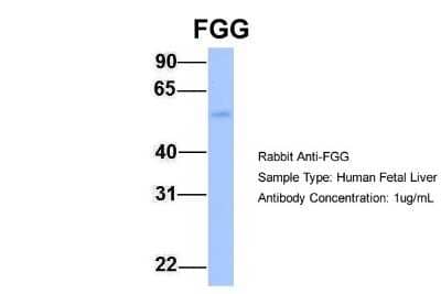 Western Blot: Fibrinogen gamma chain Antibody [NBP1-69291] - Human Fetal Liver, Antibody Dilution: 1.0 ug/ml.