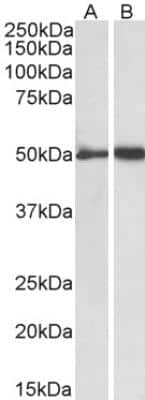 Western Blot: Fibrinogen gamma chain Antibody [NBP2-42497] - Analysis of human Plasma (A) and Platelets (B) lysates (35ug protein in RIPA buffer). Primary incubation was 1 hour. Detected by chemiluminescence.