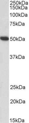 Western Blot: Fibrinogen gamma chain Antibody [NBP2-42498] - Staining of Human Platelets lysate (35 ug protein in RIPA buffer). Primary incubation was 1 hour. Detected by chemiluminescence.  