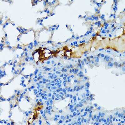 Immunohistochemistry-Paraffin: Fibrinopeptide A Antibody (7K8J1) [NBP3-15843] - Mouse lung using Fibrinopeptide A (FGA) Rabbit mAb (NBP3-15843) at dilution of 1:100 (40x lens).Perform microwave antigen retrieval with 10 mM Tris/EDTA buffer pH 9.0 before commencing with IHC staining protocol.