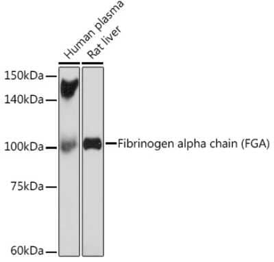 Western Blot: Fibrinopeptide A Antibody (7K8J1) [NBP3-15843] - Analysis of extracts of various cell lines, using Fibrinopeptide A (FGA) Rabbit mAb (NBP3-15843) at 1:1000 dilution. Secondary antibody: HRP Goat Anti-Rabbit IgG (H+L) at 1:10000 dilution. Lysates/proteins: 25ug per lane. Blocking buffer: 3% nonfat dry milk in TBST. Detection: ECL Basic Kit. Exposure time: 180s.