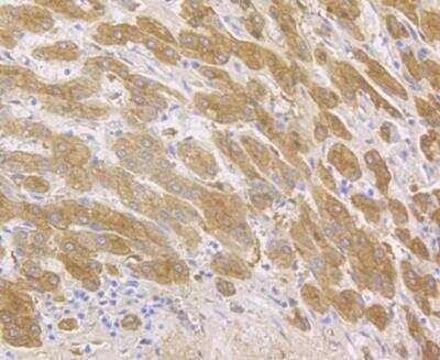 Immunohistochemistry-Paraffin: Fibrinopeptide A Antibody (D5-B3) [NBP2-66842] - Immunohistochemical analysis of paraffin-embedded human liver tissue using anti-Fibrinogen antibody. The section was pre-treated using heat mediated antigen retrieval with Tris-EDTA buffer (pH 8.0-8.4) for 20 minutes.The tissues were blocked in 5% BSA for 30 minutes at room temperature, washed with ddH2O and PBS, and then probed with the antibody at 1/50 dilution, for 30 minutes at room temperature and detected using an HRP conjugated compact polymer system. DAB was used as the chromogen. Counter stained with hematoxylin and mounted with DPX.