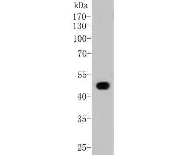 Western Blot: Fibrinopeptide A Antibody (D5-B3) [NBP2-66842] - Western blot analysis of Fibrinogen on HepG2 cell lysate. Proteins were transferred to a PVDF membrane and blocked with 5% BSA in PBS for 1 hour at room temperature. The primary antibody (1/100) was used in 5% BSA at room temperature for 2 hours. Goat Anti-Rabbit IgG - HRP Secondary Antibody at 1:5,000 dilution was used for 1 hour at room temperature.