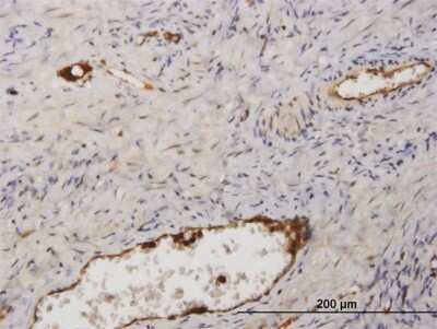 Immunohistochemistry-Paraffin: Fibrinopeptide A Antibody [H00002243-D01P] - Analysis of rabbit antibody to FGA on formalin-fixed paraffin-embedded human ovary. Antibody concentration 1.5 ug/ml.