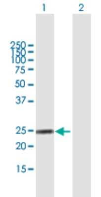 Western Blot: Fibrinopeptide A Antibody [H00002243-B01P] - Analysis of FGA expression in transfected 293T cell line by FGA polyclonal antibody.  Lane 1: FGA transfected lysate(24.09 KDa). Lane 2: Non-transfected lysate.