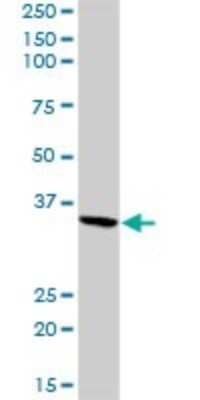 Western Blot: Fibrinopeptide A Antibody [H00002243-D01P] - Analysis of FGA expression in mouse kidney.