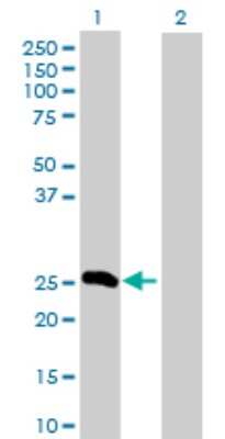 Western Blot: Fibrinopeptide A Antibody [H00002243-D01P] - Analysis of FGA expression in transfected 293T cell line by FGA polyclonal antibody.Lane 1: FGA transfected lysate(24.70 KDa).Lane 2: Non-transfected lysate.