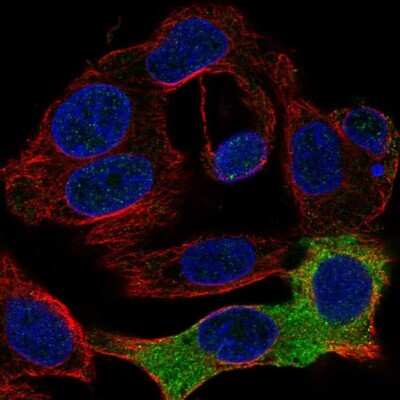 Immunocytochemistry/Immunofluorescence: Fibrinogen beta chain Antibody [NBP1-90955] - Staining of human cell line Hep G2 shows localization to endoplasmic reticulum.