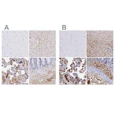 Immunohistochemistry-Paraffin: Fibrinogen beta chain Antibody [NBP1-90955] - Staining of human cerebral cortex, liver, placenta and rectum using Fibrinogen beta chain antibody NBP1-90955 (A) shows similar protein distribution across tissues to independent antibody NBP1-90956 (B).