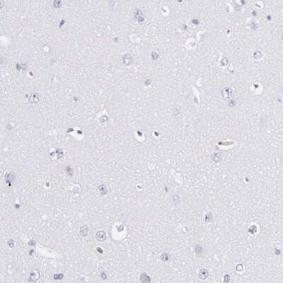 Immunohistochemistry-Paraffin: Fibrinogen beta chain Antibody [NBP1-90955] - Staining of human cerebral cortex shows no positivity in neurons as expected.