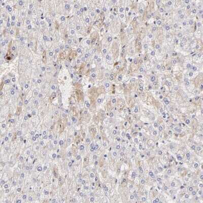 Immunohistochemistry-Paraffin: Fibrinogen beta chain Antibody [NBP1-90955] - Staining of human liver shows weak cytoplasmic positivity in hepatocytes.