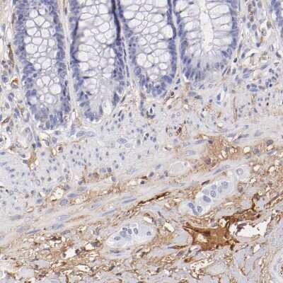 Immunohistochemistry-Paraffin: Fibrinogen beta chain Antibody [NBP1-90955] - Staining of human rectum shows moderate  positivity in plasma in blood vessels, as well as positivity in extracellular matrix.