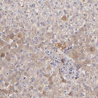 Immunohistochemistry-Paraffin: Fibrinogen beta chain Antibody [NBP1-90956] - Staining of human liver shows moderate cytoplasmic positivity in hepatocytes.