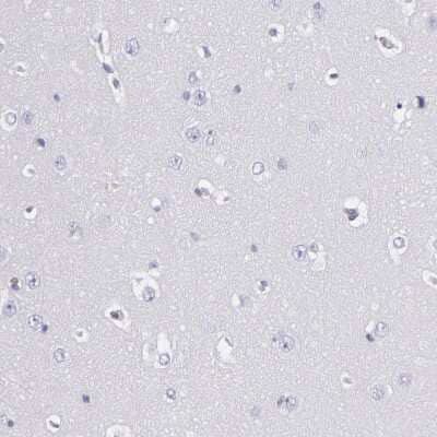 Immunohistochemistry-Paraffin: Fibrinogen beta chain Antibody [NBP1-90956] - Staining of human cerebral cortex shows no positivity in neurons as expected.