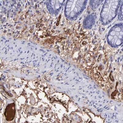 Immunohistochemistry-Paraffin: Fibrinogen beta chain Antibody [NBP1-90956] - Staining of human rectum shows strong positivity in plasma in blood vessels, as well as positivity in extracellular matrix.