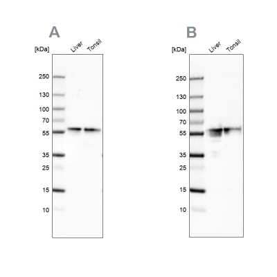 <b>Independent Antibodies Validation. </b>Western Blot: Fibrinogen beta chain Antibody [NBP1-90955] - Analysis using Fibrinogen beta chain  antibody NBP1-90955 (A) shows similar pattern to independent antibody NBP1-90956 (B).