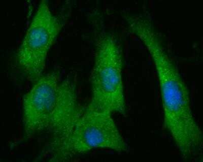 Immunocytochemistry/Immunofluorescence: Fibroblast Activation Protein alpha/FAP Antibody [NBP2-89135] - Staining FAP in NIH-3T3 cells (green). The nuclear counter stain is DAPI (blue). Cells were fixed in paraformaldehyde, permeabilised with 0.25% Triton X100/PBS.