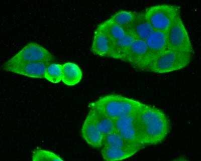 Immunocytochemistry/Immunofluorescence: Fibroblast Activation Protein alpha/FAP Antibody [NBP2-89135] - Staining FAP in Hela cells (green). The nuclear counter stain is DAPI (blue). Cells were fixed in paraformaldehyde, permeabilised with 0.25% Triton X100/PBS.