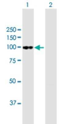 Western Blot: Fibroblast Activation Protein alpha/FAP Antibody [H00002191-B01P] - Analysis of FAP expression in transfected 293T cell line by FAP polyclonal antibody.  Lane 1: FAP transfected lysate(83.6 KDa). Lane 2: Non-transfected lysate.