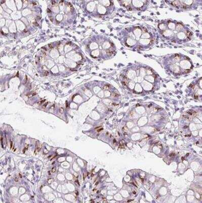 Immunohistochemistry: Fibroblast Growth Factor Binding Protein 3 Antibody [NBP2-30824] - Staining of human colon shows strong cytoplasmic positivity in goblet cells.