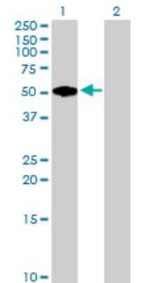 Western Blot: Fibromodulin/FMOD Antibody [H00002331-B02P] - Analysis of FMOD expression in transfected 293T cell line by FMOD polyclonal antibody.  Lane 1: FMOD transfected lysate(41.36 KDa). Lane 2: Non-transfected lysate.